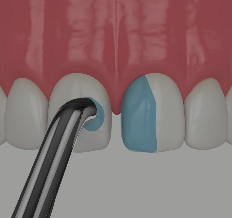 Treatment - KT Dental