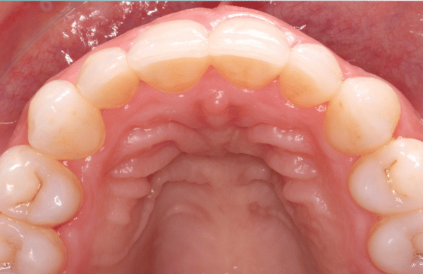 After - brecknockdental