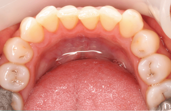 Before - brecknockdental