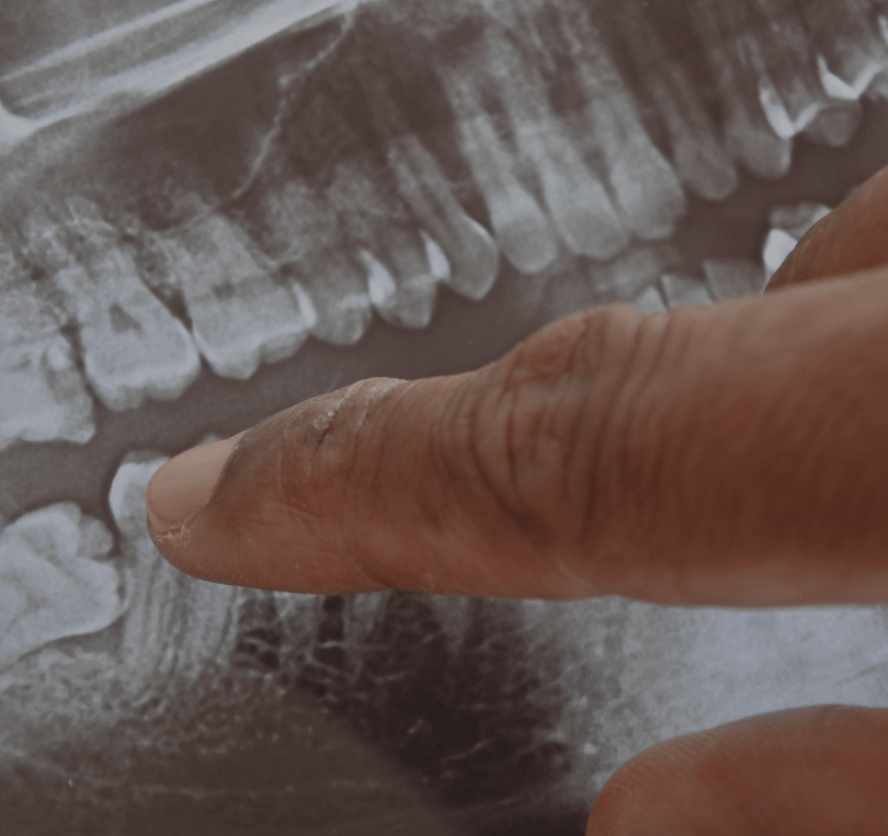 Treatment - KT Dental