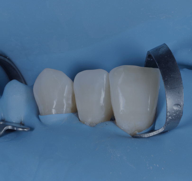 Treatment - KT Dental